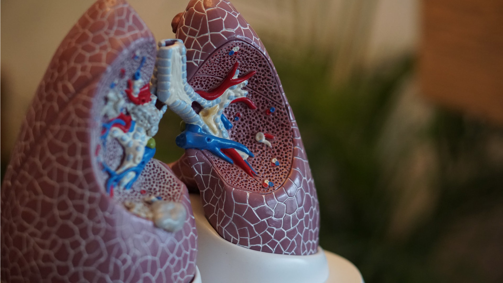 natera-launches-prospera-lung-transplant-assessment-test-healthcare