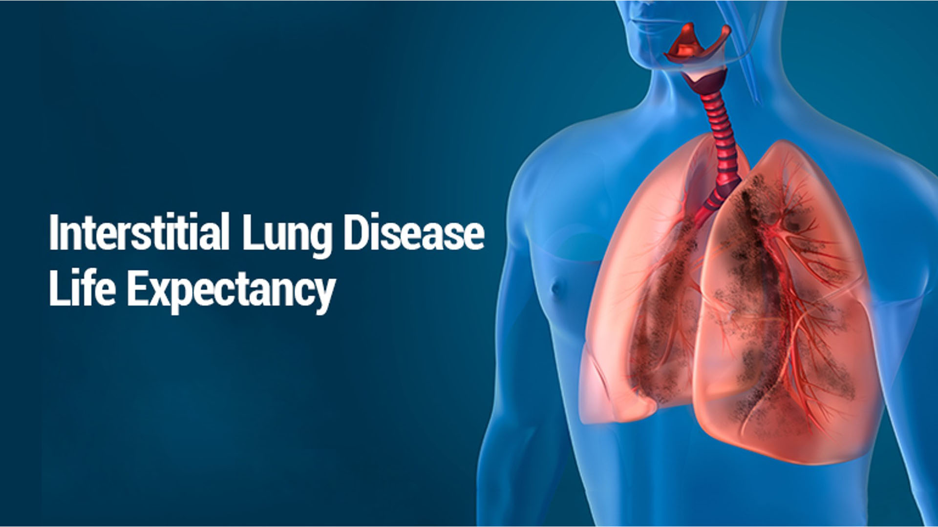 Specialised Clinics For Asthma ILD Interstitial Lung Diseases Launched By Yashoda Hospitals