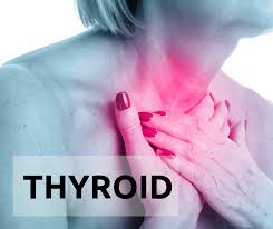 Making Indian women thyroid aware - Healthcare Radius