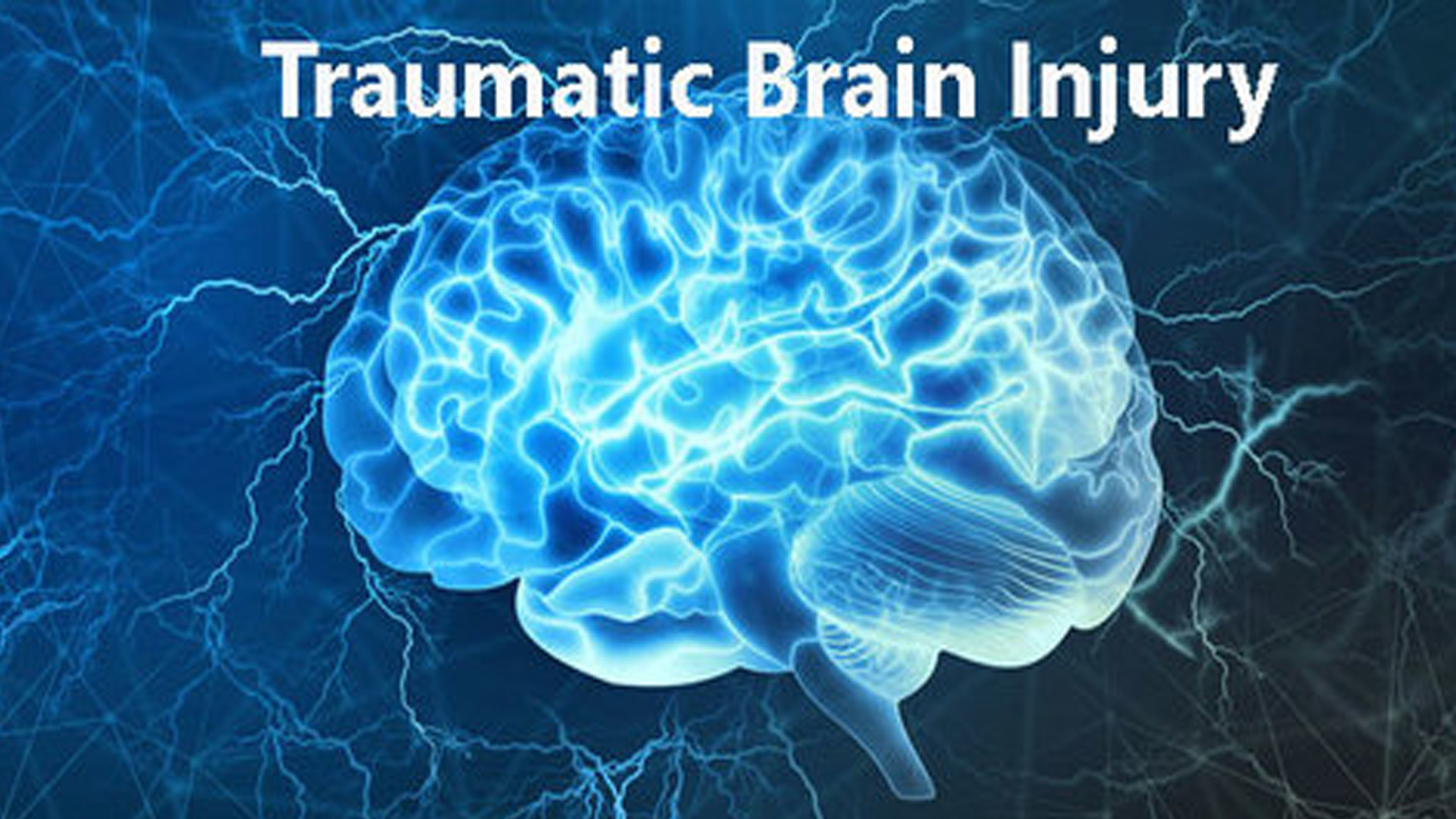 UAB team to trial FDA-cleared device for traumatic brain injury ...