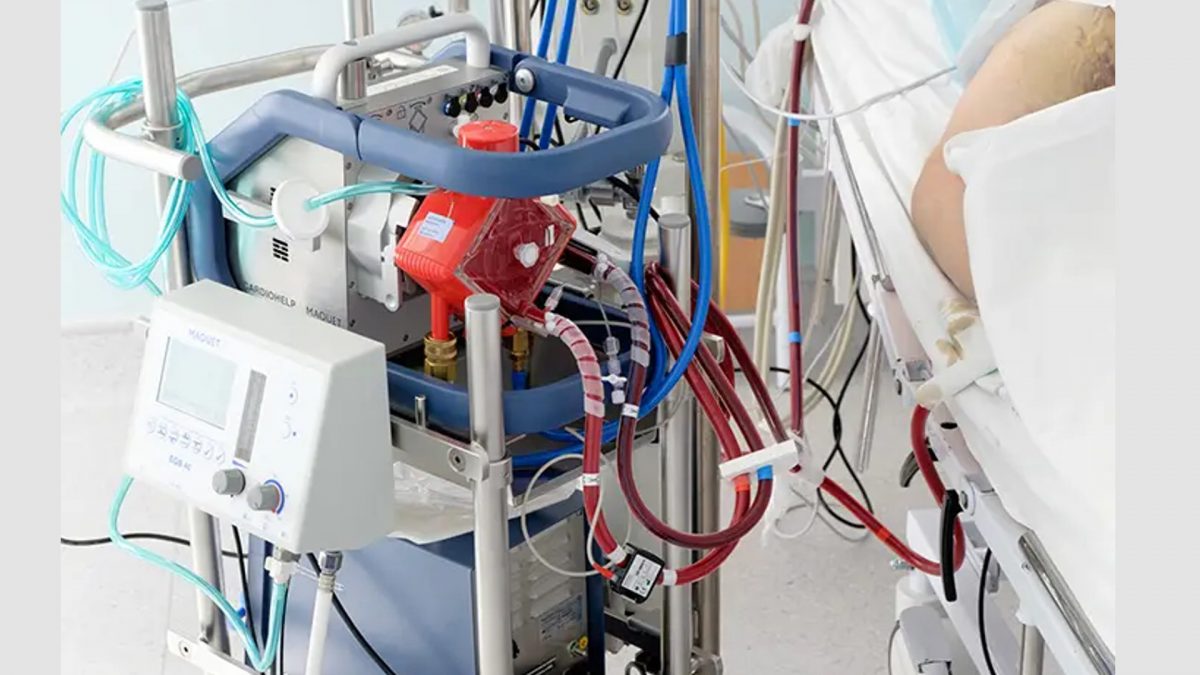 ECMO therapy helps to recover lung function in a majority of patients ...