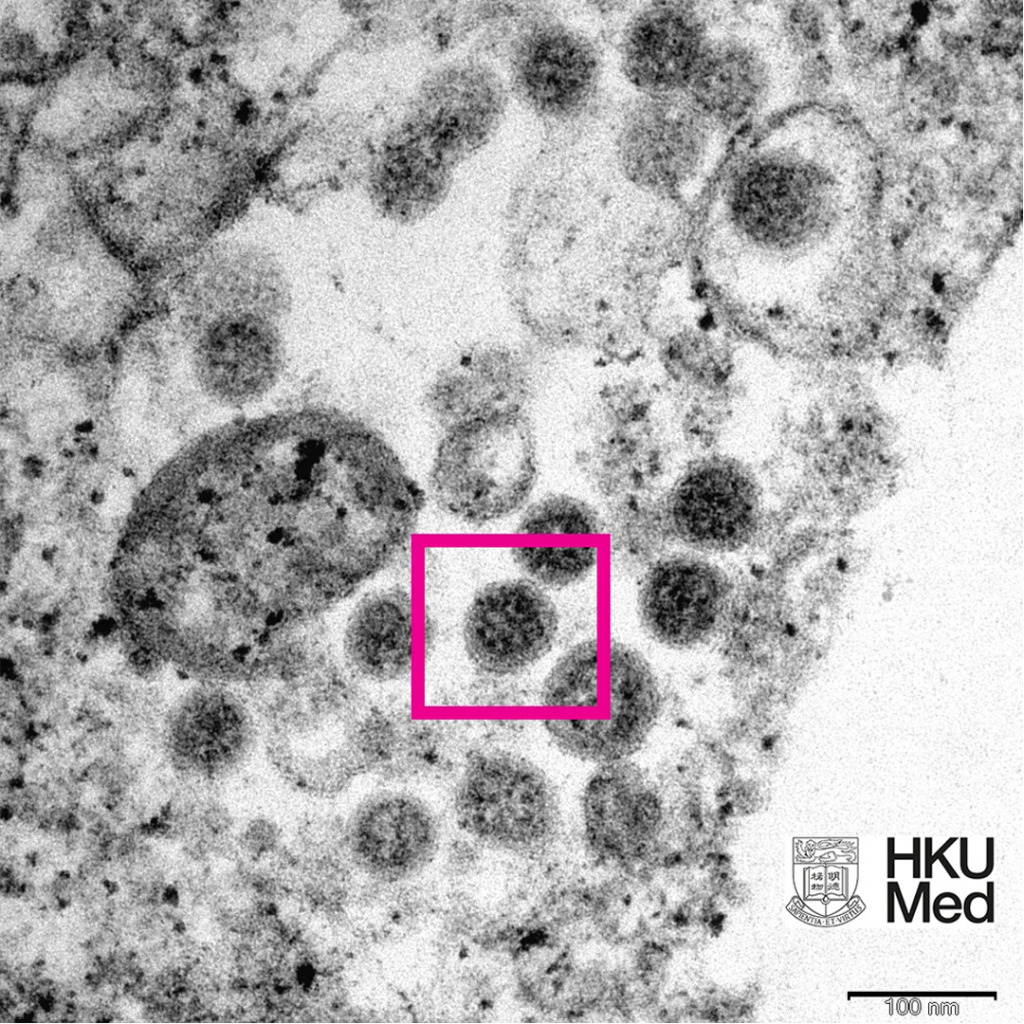 Covid-19: Peak of viral shedding is later with omicron variant ...