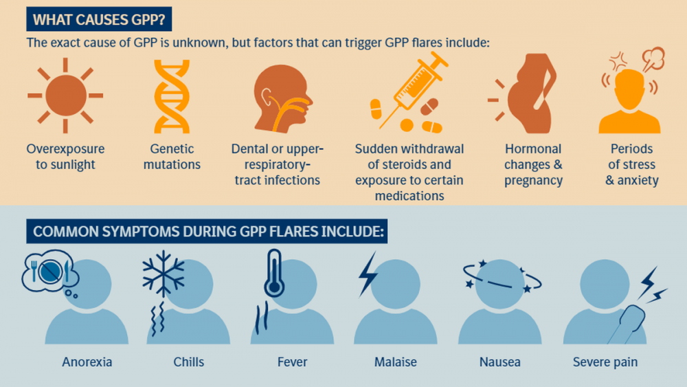 USFDA approves Spesolimab as first treatment option for GPP flares ...