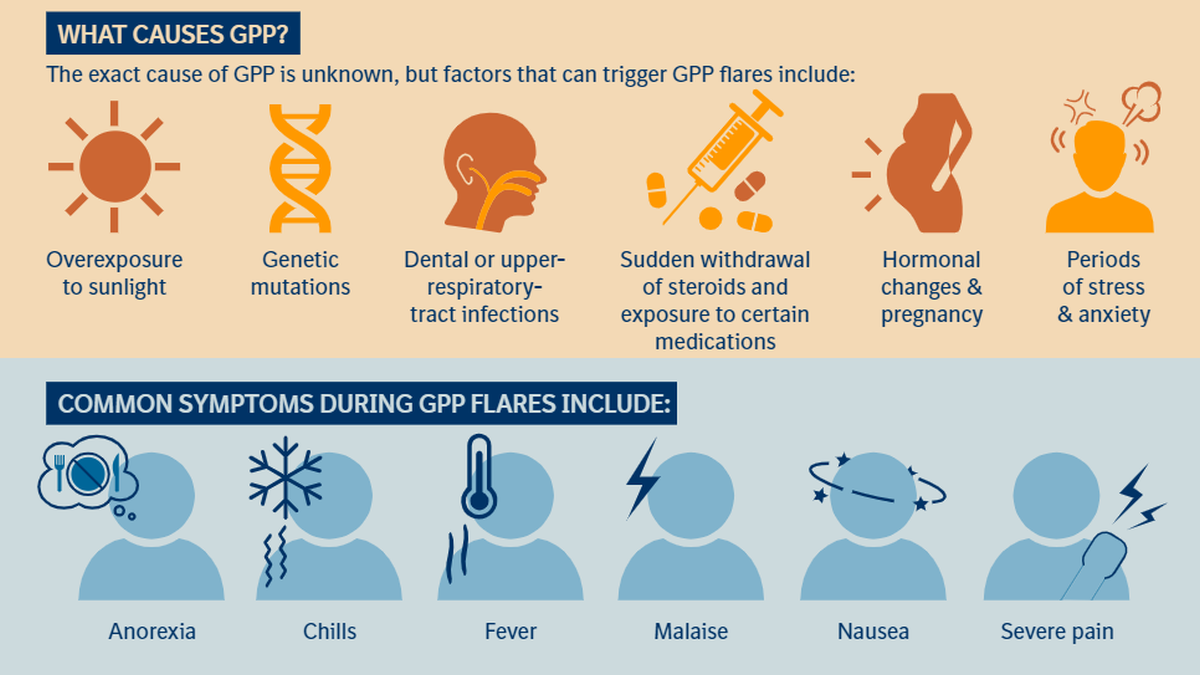 Usfda Approves Spesolimab As First Treatment Option For Gpp Flares