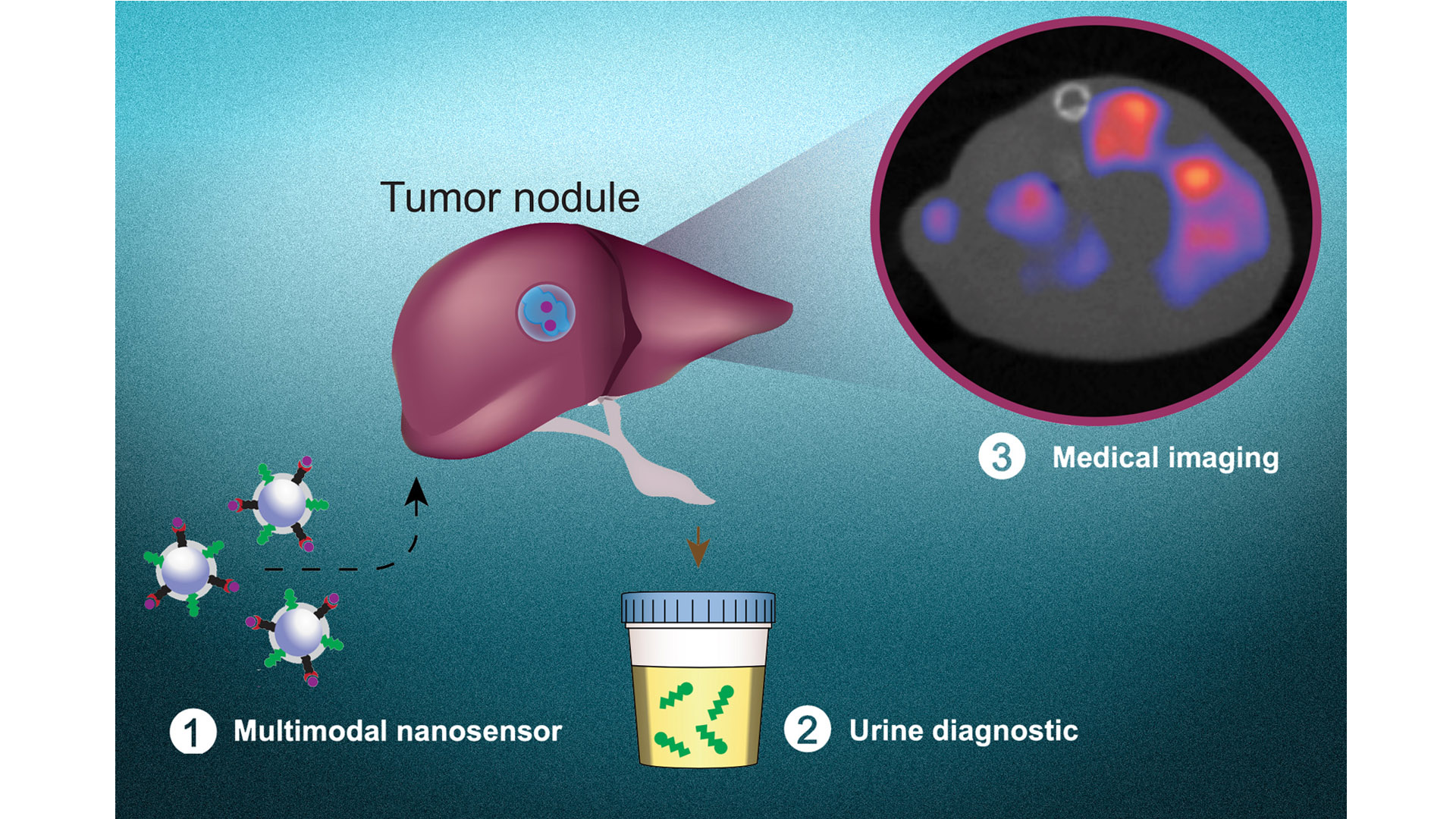 a-noninvasive-test-to-detect-cancer-cells-and-pinpoint-their-location