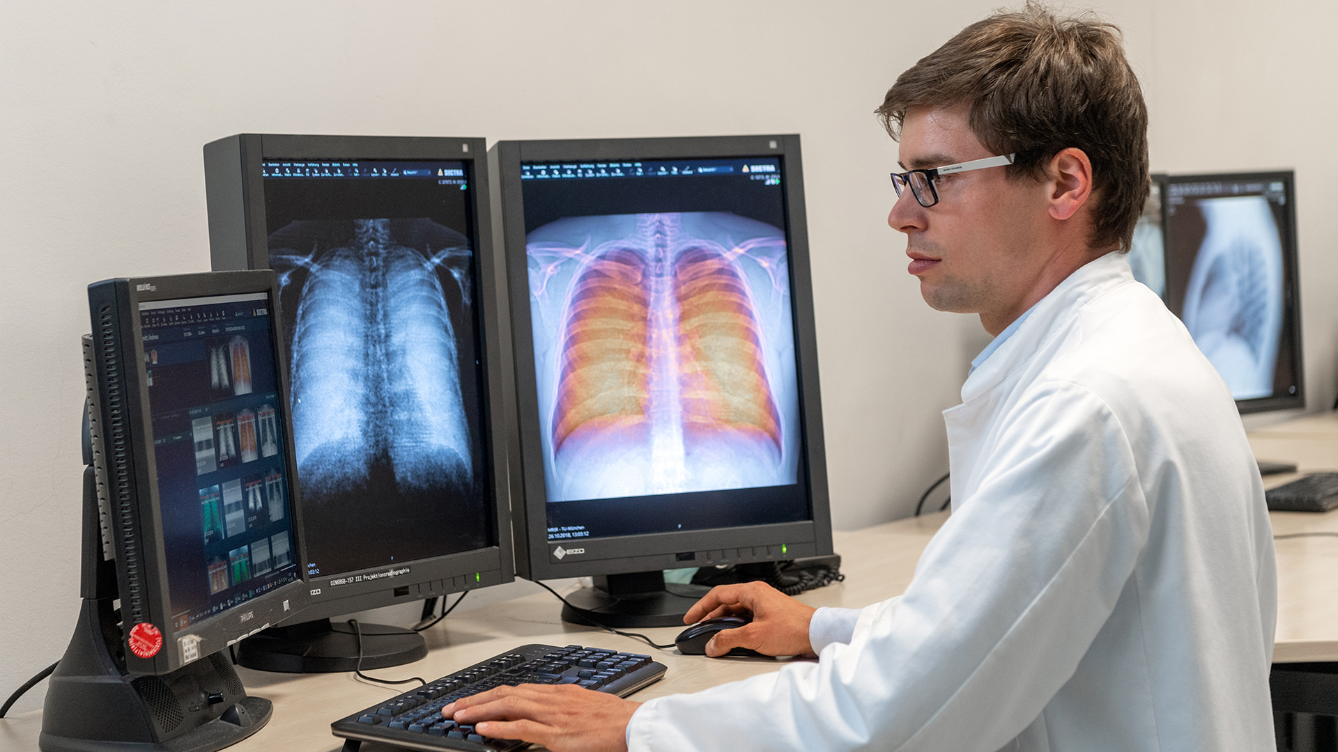 New X-ray technology first used with patients - Diagnostic & Radiology ...